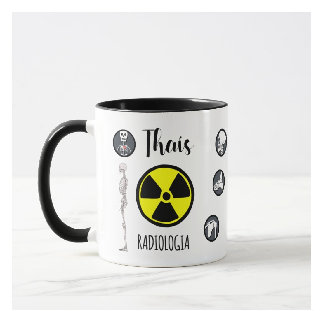 Caneca Criativa Radiologia Personalizada Radiologistas Nomes