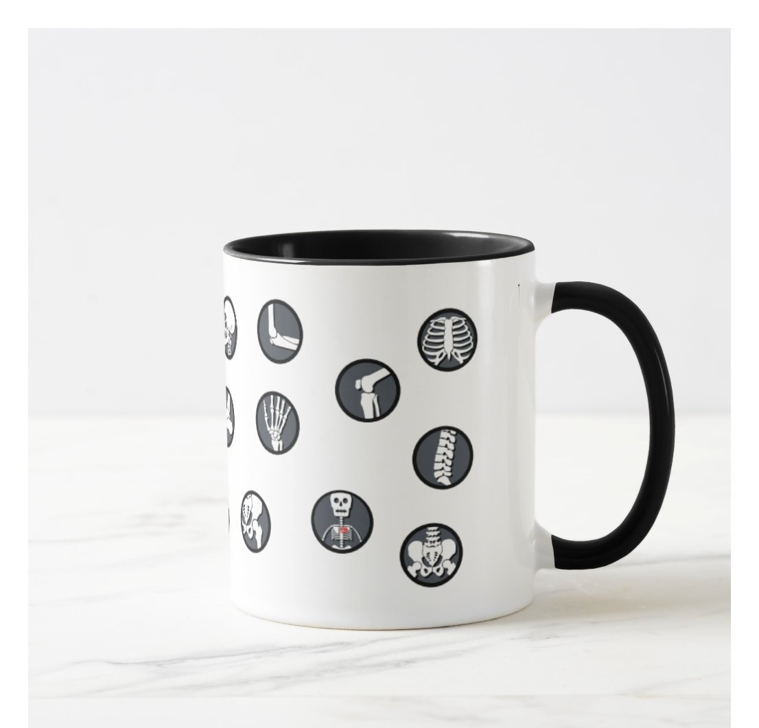 Caneca Criativa Radiologia Personalizada Radiologistas Nomes